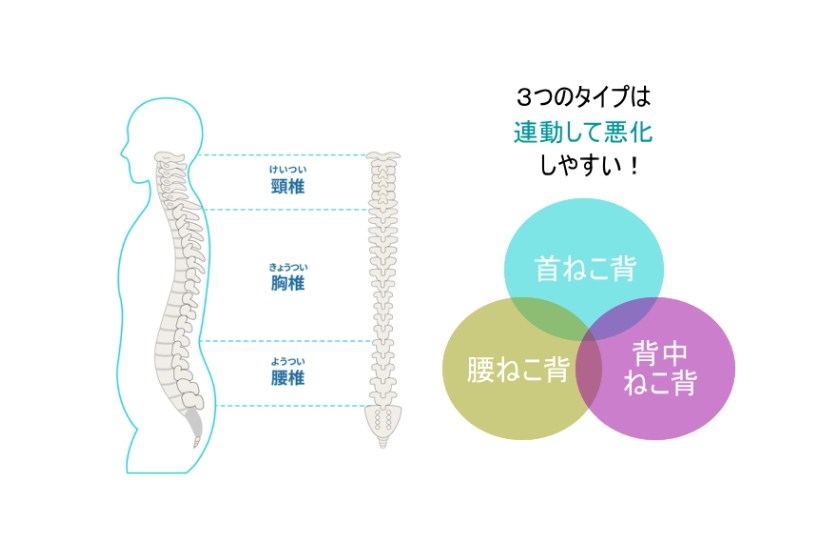 セナレッチ