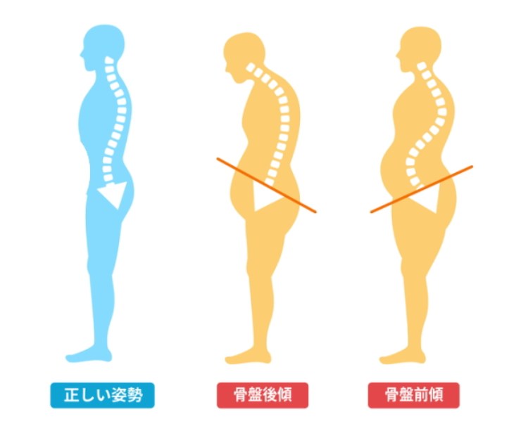 セナレッチ